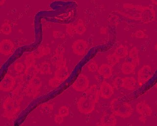 5 things to know about the Ebola virus